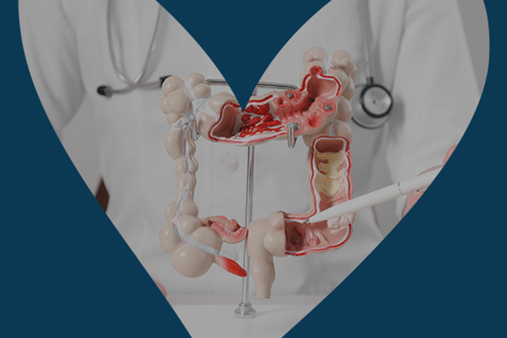 Stomaco e intestino felici_CATEGORIA